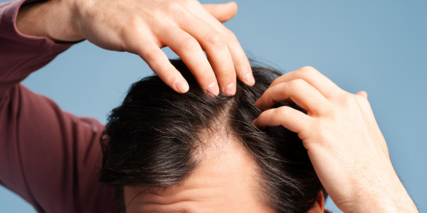 HAIR LOSS REPLACEMENT